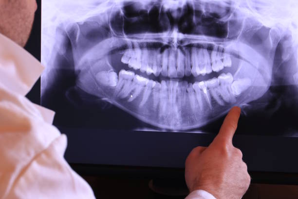 Best Emergency Tooth Extraction  in Deenwood, GA